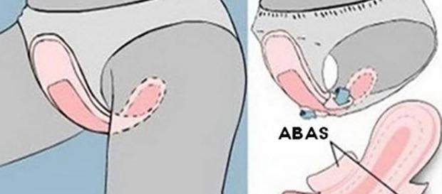 Utilizar o absorvente de forma correta evita muitos incômodos durante a menstruação Utilizar o absorvente de forma correta evita muitos incômodos durante a menstruação