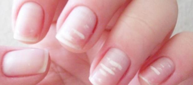 Você possui essas manchas? Elas podem ser sinal de doença Você possui essas manchas? Elas podem ser sinal de doença
