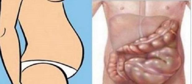 A tua barriga está inchada? Talvez não seja gordura A tua barriga está inchada? Talvez não seja gordura