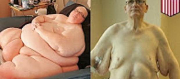 Source: Youtube user TomoNews: World's Fattest Man no more Paul Mason weight loss Source: Youtube user TomoNews: World's Fattest Man no more Paul Mason weight loss