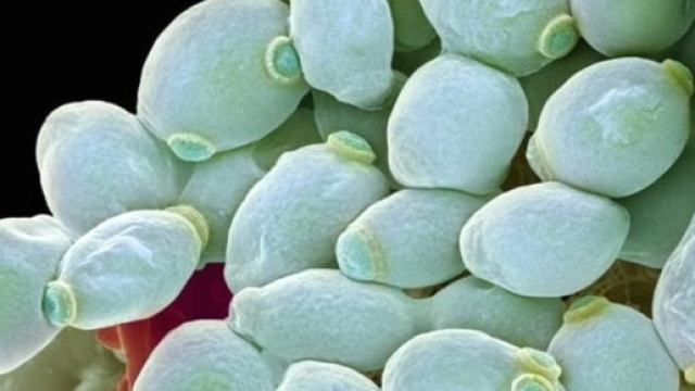 Usa, Candida Auris grave minaccia per la salute.