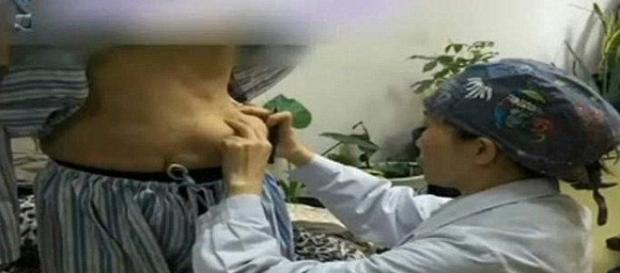 Hidrogel falha e mulher diz que os seios desceram para o estômago (Foto: google imagen) Hidrogel falha e mulher diz que os seios desceram para o estômago (Foto: google imagen)