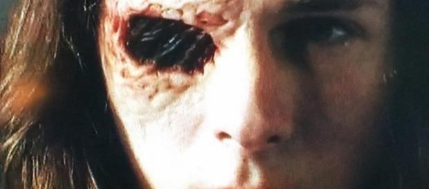 Negan makes Carl walk around with his eye exposed. Photo: Blasting News Library - cosmicbooknews.com Negan makes Carl walk around with his eye exposed. Photo: Blasting News Library - cosmicbooknews.com