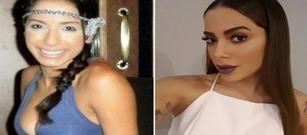 Além das sobrancelhas, Anitta também teve os lábios transformados Além das sobrancelhas, Anitta também teve os lábios transformados