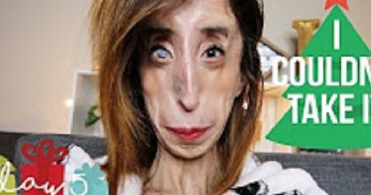 Lizzie Velasquez World S Ugliest Woman Gently Confronts Cruel Memes Breaks Hearts