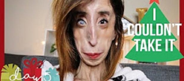 Lizzie Velasquez World S Ugliest Woman Gently Confronts Cruel Memes Breaks Hearts