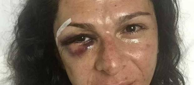 La exatleta compartió la imagen en redes sociales La exatleta compartió la imagen en redes sociales
