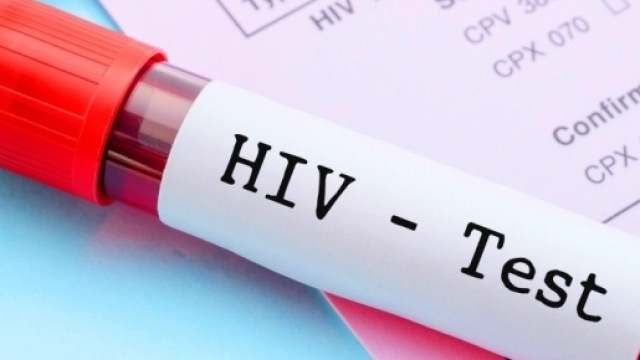HIV e minori: quali restrizioni per l'accesso al test, e perch&eacute; ... - responsabilecivile.it