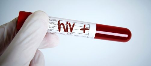 Aids: autotest Hiv in vendita nelle farmacie