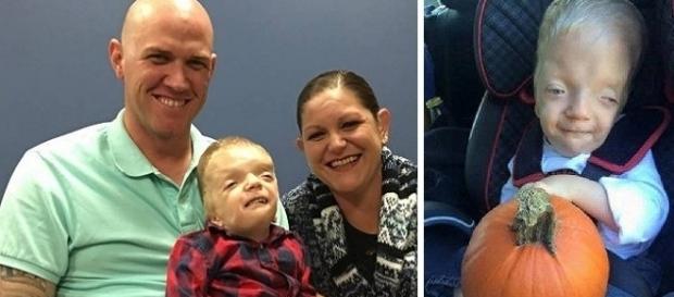 Mãe de criança com anomalias que virou meme desabafa: “nojento”. Mãe de criança com anomalias que virou meme desabafa: “nojento”.