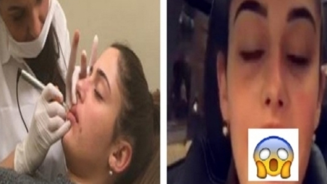Coralie Porrovecchio avait pourtant juré de ne jamais céder à l'appel du bistouri