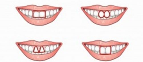 Seus dentes pode indicar se você tem uma personalidade egoísta.