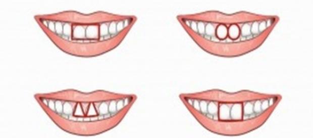 Seus dentes pode indicar se você tem uma personalidade egoísta. Seus dentes pode indicar se você tem uma personalidade egoísta.