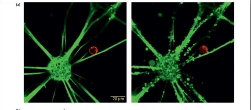 Un neurone, in verde, attaccato da un linfocita T, in rosso (da "Neurons as targets for T cells in the nervous system", Liblau et al. TINS 2013)