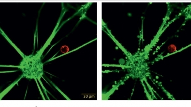 Un neurone, in verde, attaccato da un linfocita T, in rosso (da "Neurons as targets for T cells in the nervous system", Liblau et al. TINS 2013)