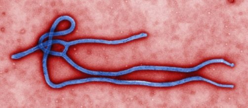 Immagine del virus ebola inattivo.