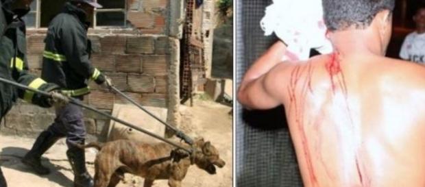 Pitbull teria atacado homem que invadiu sua casa - Google Pitbull teria atacado homem que invadiu sua casa - Google