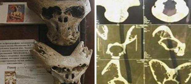 'Aliens' estavam no interior de uma caixa com a insígnia do instituto nazista Ahnenerbe (Daily Star) 'Aliens' estavam no interior de uma caixa com a insígnia do instituto nazista Ahnenerbe (Daily Star)