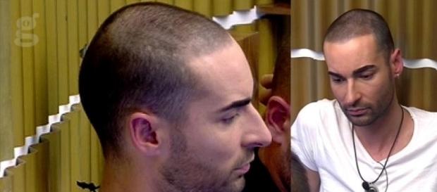 GH17: Demostrada la falsa calvicie de Miguel GH17: Demostrada la falsa calvicie de Miguel