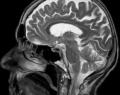 fMRI study shows you remember the same way Sherlock Holmes and everyone else does