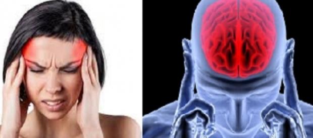 Mulheres com enxaqueca têm um risco maior em desenvolver doenças cardiovasculares Mulheres com enxaqueca têm um risco maior em desenvolver doenças cardiovasculares