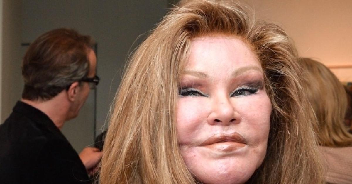 Jocelyn Catwoman Wildensteins Mugshot Reveals Shocking Plastic Surgeries