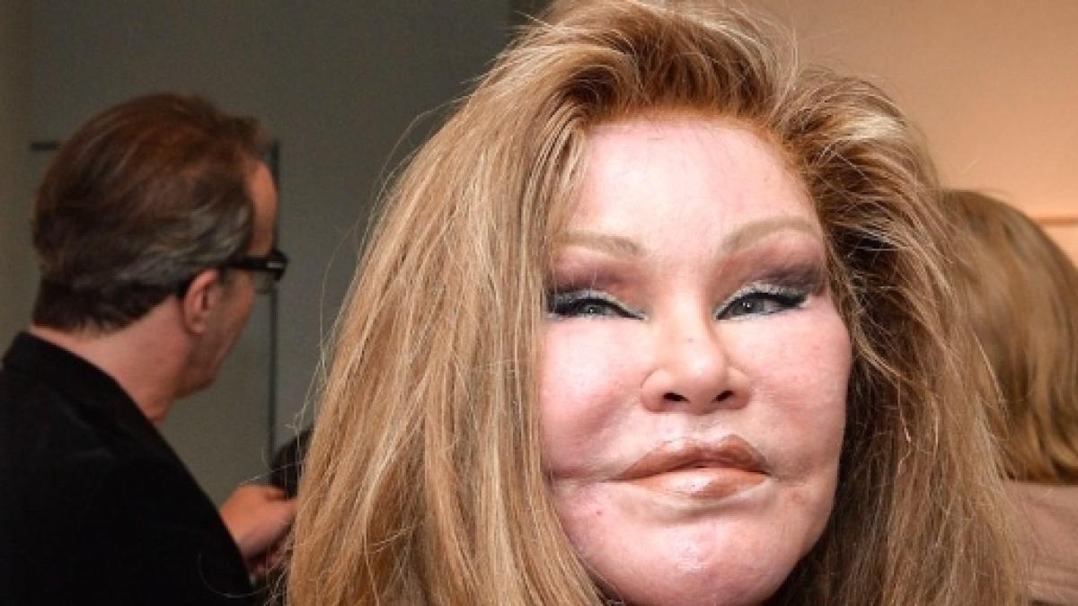 Jocelyn Catwoman Wildenstein S Mugshot Reveals Shocking Plastic Surgeries