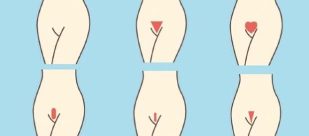 Eleva o risco do contágio de sífilis, clamídia e herpes, devido ao tipo de depilação. Eleva o risco do contágio de sífilis, clamídia e herpes, devido ao tipo de depilação.