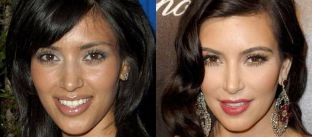 El antes y después de Kim Kardashian El antes y después de Kim Kardashian