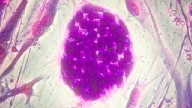 Scoperta la proteina MICAL2 pro-metastasi