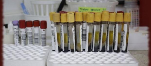 Firma indiană care are leacul contra Zika Firma indiană care are leacul contra Zika