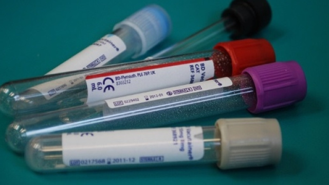 Virus sotto esame nei laboratori di tutto il mondo