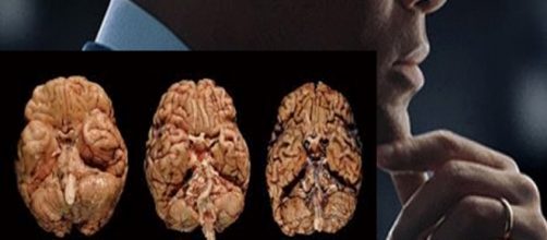 O Ator Will Smith e imagens de cérebros com a ETC