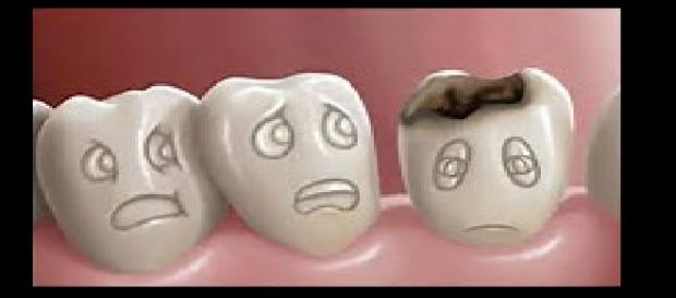 Las caries se contagian de persona a persona Las caries se contagian de persona a persona