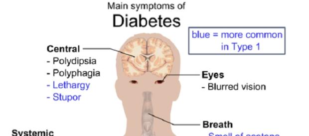 Diabetis symptoms (Mikael Häggström Public Domain) Diabetis symptoms (Mikael Häggström Public Domain)