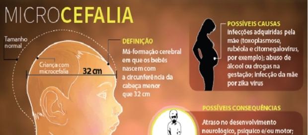 Má formação cerebral leva ao nascimento de crianças deficientes Má formação cerebral leva ao nascimento de crianças deficientes