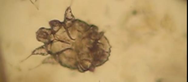 Acaro Sarcoptes Scabei -Il contagio avviene, soprattutto, pelle-pelle, quindi attraverso il contatto Acaro Sarcoptes Scabei -Il contagio avviene, soprattutto, pelle-pelle, quindi attraverso il contatto