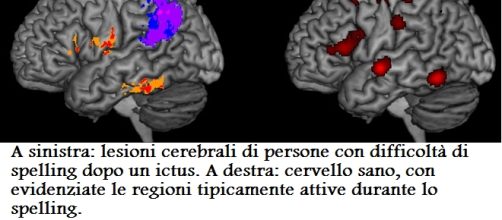 Tratta dal comunicato Johns Hopkins University.