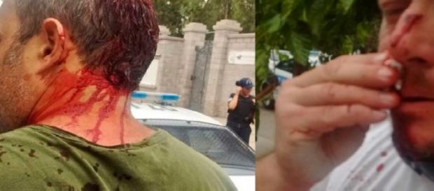 Roberto Macho, golpeado ferozmente hoy Roberto Macho, golpeado ferozmente hoy
