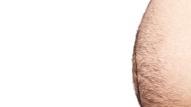 Pancetta, fa ammalare pi&ugrave; dell'obesit&agrave;