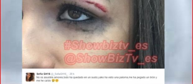 Sofía estrena trono lesionada! Sofía estrena trono lesionada!