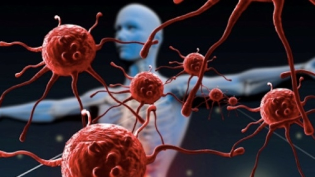 I fattori di rischio cardiometabolici si associano all'insorgenza tumorale.