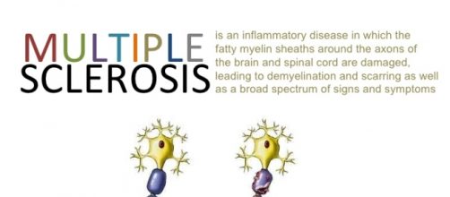 La sclerosi multipla degrada la mielina