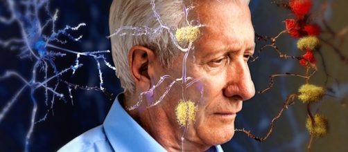 Speranze per la terapia dell'Alzheimer da una sostanza del sistema immunitario