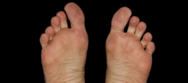 Saúde e bem estar podem começar com pés saudáveis Saúde e bem estar podem começar com pés saudáveis