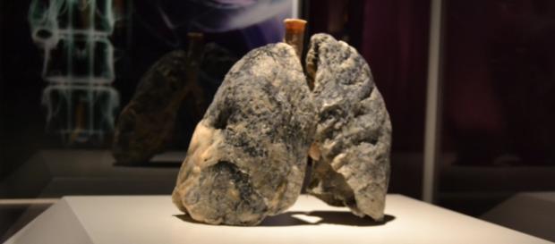 Real Bodies: Raucherlunge, plastiniert Real Bodies: Raucherlunge, plastiniert