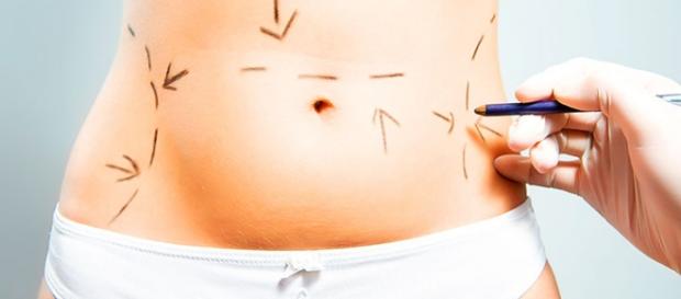 Las cirugias esteticas estan moviendo en gran manera el mercado farmacéutico Las cirugias esteticas estan moviendo en gran manera el mercado farmacéutico