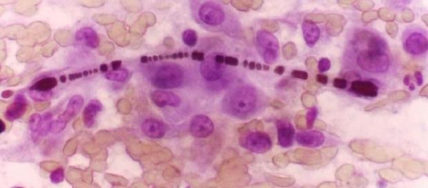 Cancro: forse sono in arrivo nuove cure Cancro: forse sono in arrivo nuove cure
