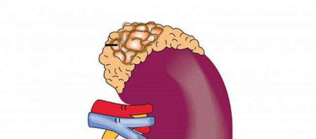 descubierto un tipo raro de cancer descubierto un tipo raro de cancer
