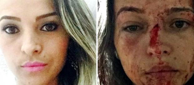 Enfermeira implorou para o lutador parar de agredi-la Enfermeira implorou para o lutador parar de agredi-la